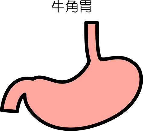 胃突出